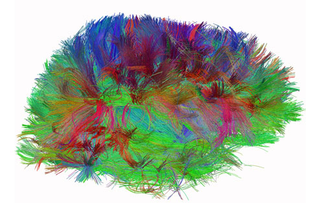 Illustration for article titled Amazing DSI Brain Scanning Visualizes Your Mind's Inner Workings In 3D
